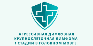 Отзыв об Ивермектине и Фенбендазоле. Агрессивная диффузная крупноклеточная лимфома 4 стадии в головном мозге. Из писем доктору У. Макису.