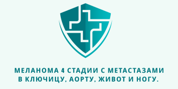 Отзыв об Ивермектине и Фенбендазоле. Меланома 4 стадии с метастазами в ключицу, аорту, живот и ногу. Из писем доктору У. Макису.